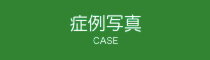 症例写真